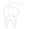 root-canal-treatment